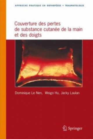 Knjiga Couverture des pertes de substance cutanée de la main et des doigts Dominique Le Nen