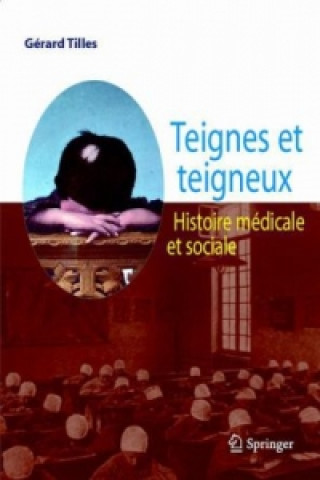 Könyv Teignes et teigneux Gérard Tilles