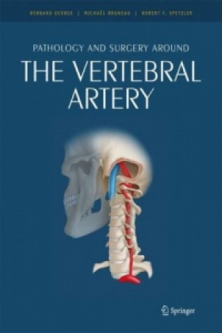 Könyv Pathology and surgery around the vertebral artery Mickaël Bruneau