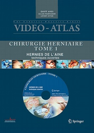 Carte Vidéo atlas Chirurgie herniaire Levent Avtan