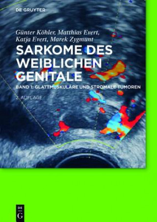 Carte Glattmuskuläre und stromale Tumoren. Bd.1 Günter Köhler
