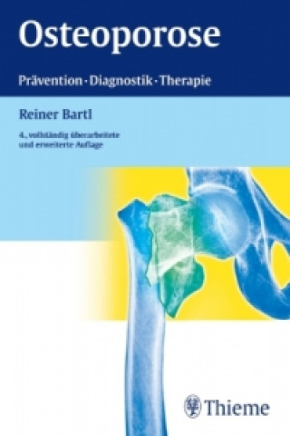 Buch Osteoporose Reiner Bartl