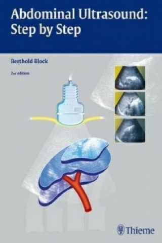 Carte Abdominal Ultrasound: Step by Step Berthold Block