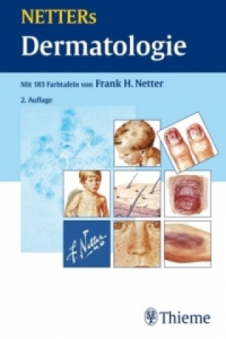 Kniha NETTERs Dermatologie Frank H. Netter
