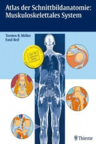 Carte Atlas der Schnittbildanatomie: Muskuloskelettales System Torsten Bert Möller