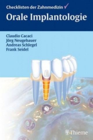 Könyv Orale Implantologie Claudio Cacaci