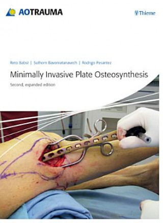 Kniha Minimally Invasive Plate Ostheosynthesis Reto Babst