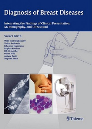 Könyv Diagnosis of Breast Diseases Volker Barth