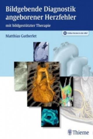Carte Bildgebende Diagnostik angeborener Herzfehler Matthias Gutberlet
