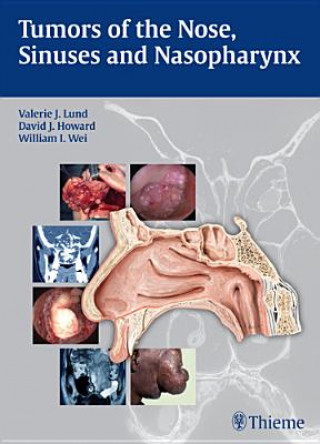 Książka Tumors of the Nose, Sinuses and Nasopharynx Valerie J. Lund