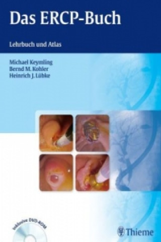 Könyv Das ERCP-Buch, m. DVD-ROM Michael Keymling