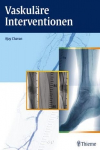 Knjiga Vaskuläre Interventionen Ajay Chavan