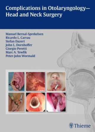 Könyv Complications in Otolaryngology - Head and Neck Surgery Manuel Bernal-Sprekelsen