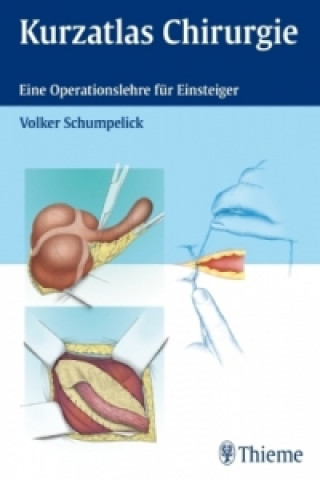 Carte Kurzatlas Chirurgie Volker Schumpelick
