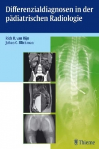 Livre Differenzialdiagnosen in der pädiatrischen Radiologie Rick R. van Rijn