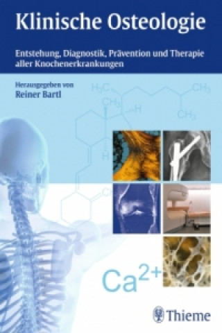 Kniha Klinische Osteologie Reiner Bartl