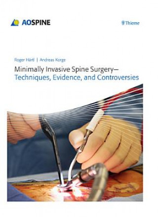Carte Minimally Invasive Spine Surgery - Techniques, Evidence, and Controversies Roger Haertl