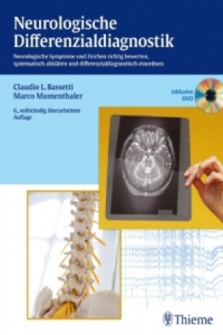 Carte Neurologische Differenzialdiagnostik, m. DVD Claudio Bassetti