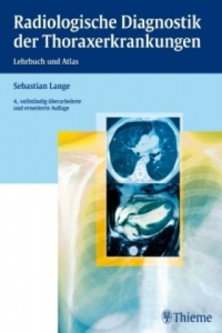 Kniha Radiologische Diagnostik der Thoraxerkrankungen Sebastian Lange