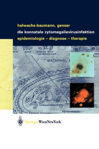 Könyv Die Konnatale Zytomegalievirusinfektion Gabriele Halwachs-Baumann