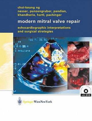 Kniha Modern Mitral Valve Repair Choi-Keung Ng