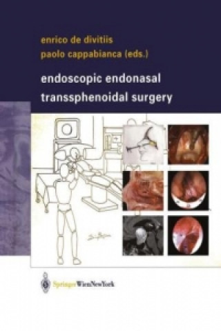 Kniha Endoscopic Endonasal Transsphenoidal Surgery Enrico de Divitiis