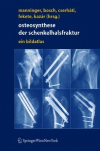Kniha Osteosynthese der schenkelhalsfraktur Jenö Manninger