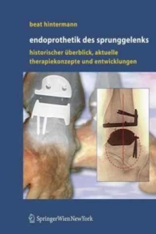 Carte Endoprothetik DES Sprunggelenks Beat Hintermann