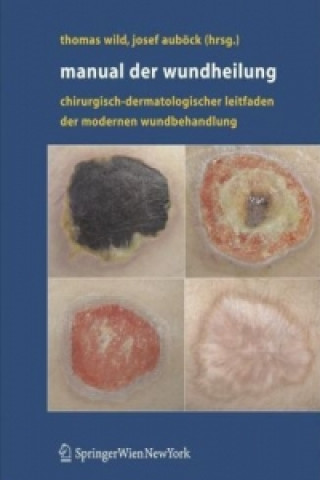 Книга Manual Der Wundheilung Thomas Wild