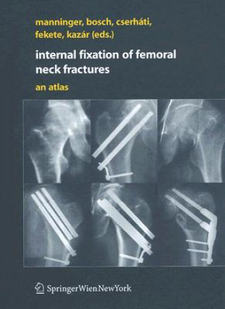 Carte Internal fixation of femoral neck fractures Jenö Manninger
