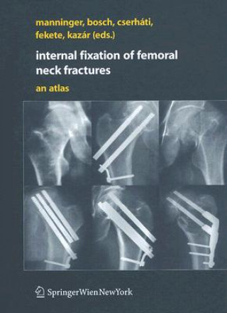 Книга Internal fixation of femoral neck fractures Jenö Manninger