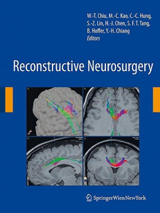 Book Reconstructive Neurosurgery Wen-Ta Chiu