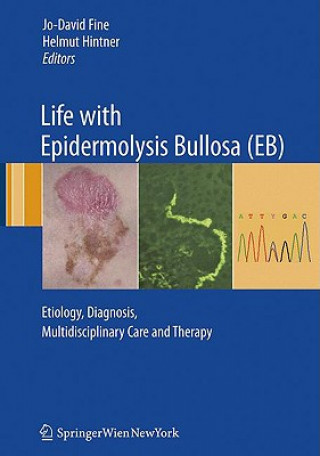 Kniha Life with Epidermolysis Bullosa (EB) Christopher Lanschützer