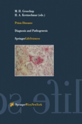 Book Prion Diseases Martin H. Groschup