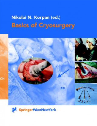 Könyv Basics of Cryosurgery Nikolai N. Korpan