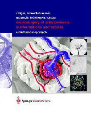 Libro Neurosurgery of Arteriovenous Malformations and Fistulas Robert Schmid-Elsaesser