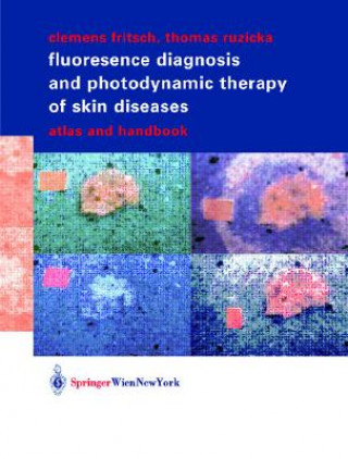 Kniha Fluorescence Diagnosis and Photodynamic Therapy of Skin Diseases Clemens Fritsch