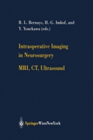 Könyv Intraoperative Imaging in Neurosurgery L. Bernays