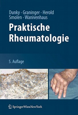 Książka Praktische Rheumatologie Attila Dunky