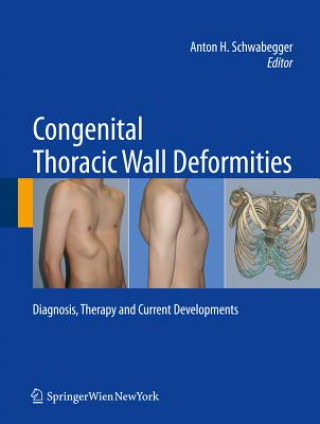 Kniha Congenital Thoracic Wall Deformities Anton H. Schwabegger