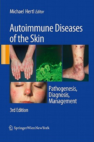 Libro Autoimmune Diseases of the Skin Michael Hertl