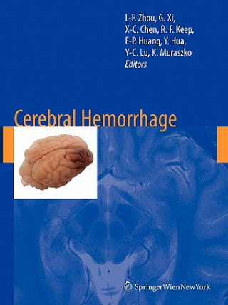 Knjiga Cerebral Hemorrhage Liang-Fu Zhou