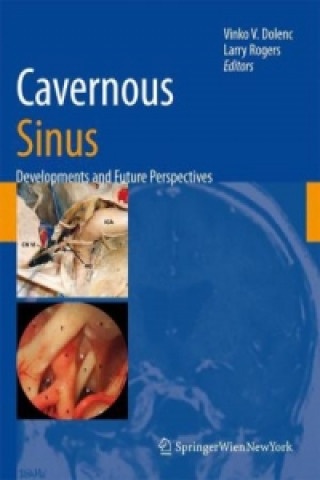 Könyv Cavernous Sinus Vinko V. Dolenc
