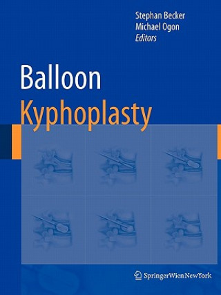 Buch Balloon Kyphoplasty Stephan Becker