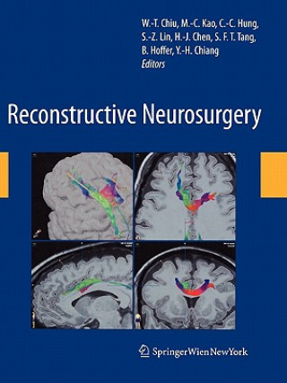 Kniha Reconstructive Neurosurgery Wen-Ta Chiu