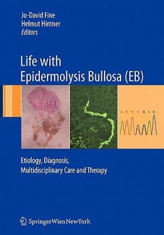 Carte Life with Epidermolysis Bullosa (EB) Jo-David Fine
