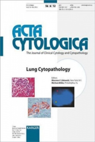 Carte Lung Cytopathology akowski