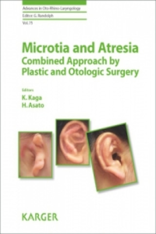 Kniha Microtia and Atresia - Combined Approach by Plastic and Otologic Surgery aga