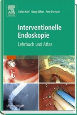 Kniha Interventionelle Endoskopie S. Kahl
