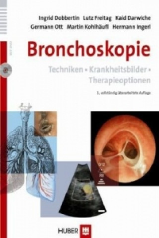Kniha Bronchoskopie,  m. DVD-ROM Ingrid Dobbertin